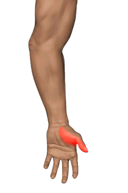 Thumb Flexors