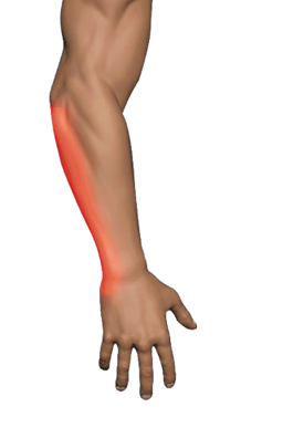 Ulnar Side Extensors