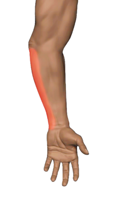 Ulnar Side Flexors
